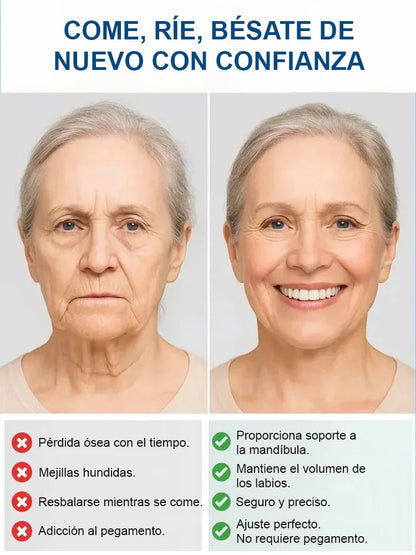 PROTESKIT – Prótesis Dental Completa con Ajuste Anatómico y Sonrisa Natural